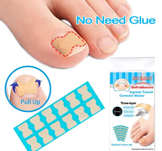 Unghia incarnita correttore adesivi cura del piede non colla toenail patch adesivo pedicur...