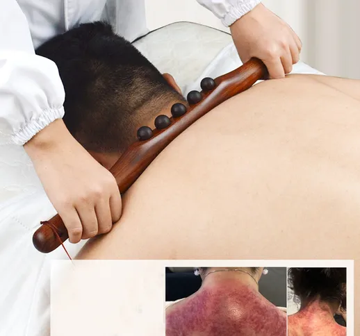 Bastone da massaggio raschiante per legno naturale carbonizzato Massaggio per il corpo Ter...