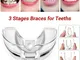 3 Stages Dental Orthodontic Braces Appliance Braces Alignment Trainer Teeth Retainer Bruxi...