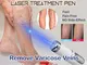 1pc Medical Blue Light Therapy Laser Pen Varicose Veins Treatment Soft Scar Wrinkle Remova...