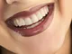 Bite antibruxismo o contenzione ortodontica e pulizia allo  (sconto 72%)