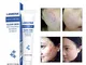 Trattamento in gel per acne, crema detergente anti acne, punti neri, cicatrici da acne e b...