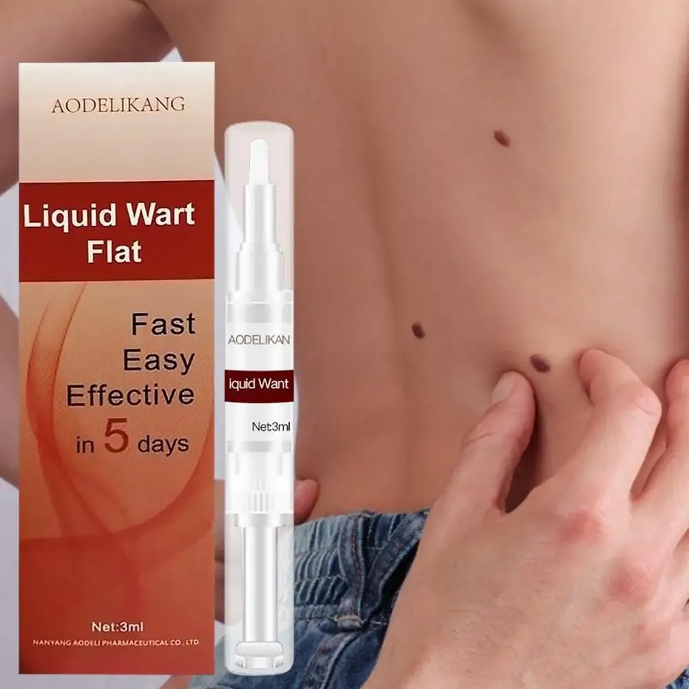 3ml Liquid Genital Wart Treatment Papillomas Removal Of Warts Skin Tags Removing Against Moles Remover Anti Verruca Remedy