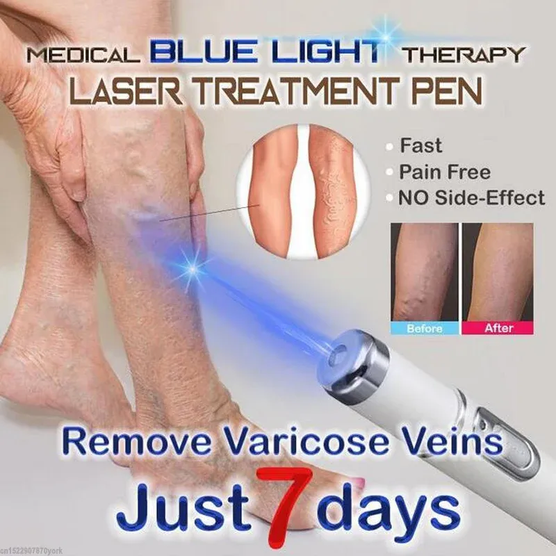 1pc Medical Blue Light Therapy Laser Pen Varicose Veins Treatment Soft Scar Wrinkle Removal Treatment Scar Acne Just 7 Days