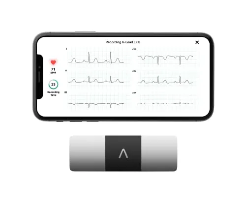 AliveCor KardiaMobile 6L ECG Portatile, L’Elettrocardiografo Personale a 1 o 6 Derivazioni per Smartphone, Rileva la Fibrillazione Atriale in Soli 30 Secondi, Distribuito da OMRON