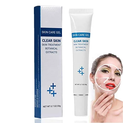 Crema per Acne e Punti Neri Gel per la Cura della Pelle Crema per l'acne di Controllo dell'olio di estratti botanici Gel brufoli Efficace Anti-Acne