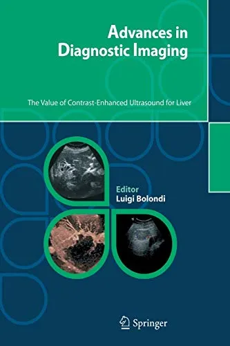 Advances in Diagnostic Imaging: The Value of Contrast-Enhanced Ultrasound for Liver