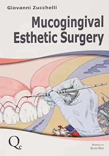 Mucogingival esthetic surgery. Nuova ediz.