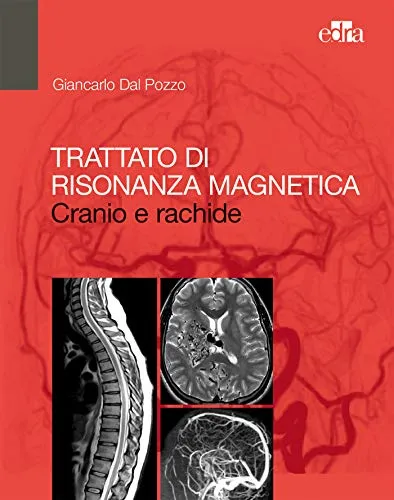 Trattato di risonanza magnetica. Cranio e rachide